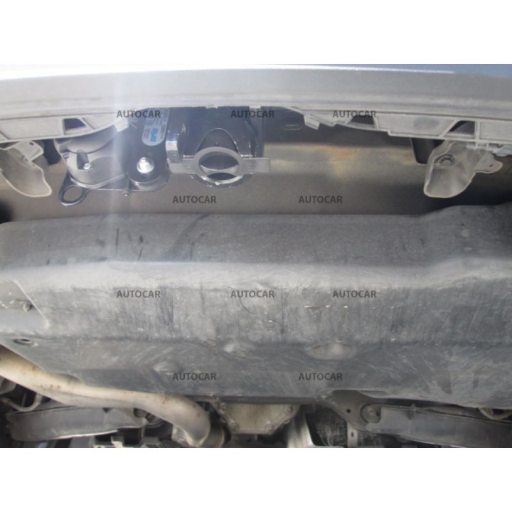 Cârlig de Remorcare Detașabil Automat, ORIS / Bosal C 4 Uși Kombi W205 S205, Mercedes-Benz C-Class 2014 - 2018 - EDK.ro