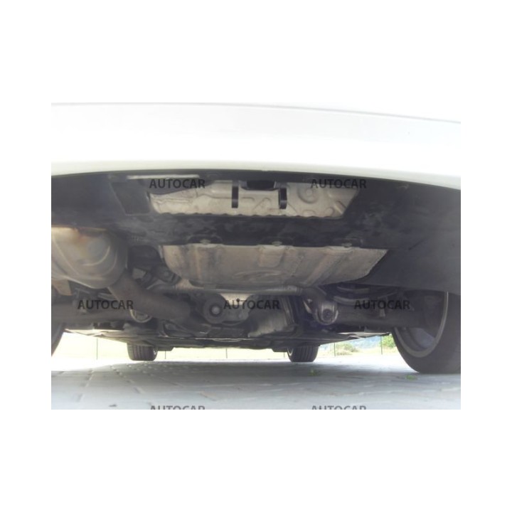 Cârlig de Remorcare Detașabil Vertical cu Cheie, Westfalia Automotive 5 F10/F11, BMW Seria 5 2014 - 2017 - EDK.ro